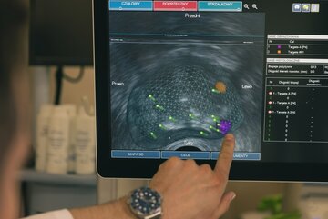 Om&oacute;wienie wynik&oacute;w biopsji fuzyjnej w&nbsp;Centrum Urologii Zaawansowanej URO.pl