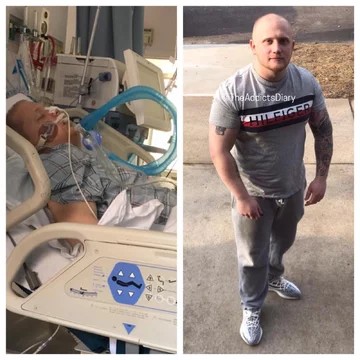 Zdjęcie przed i po wyjściu z nałogu 