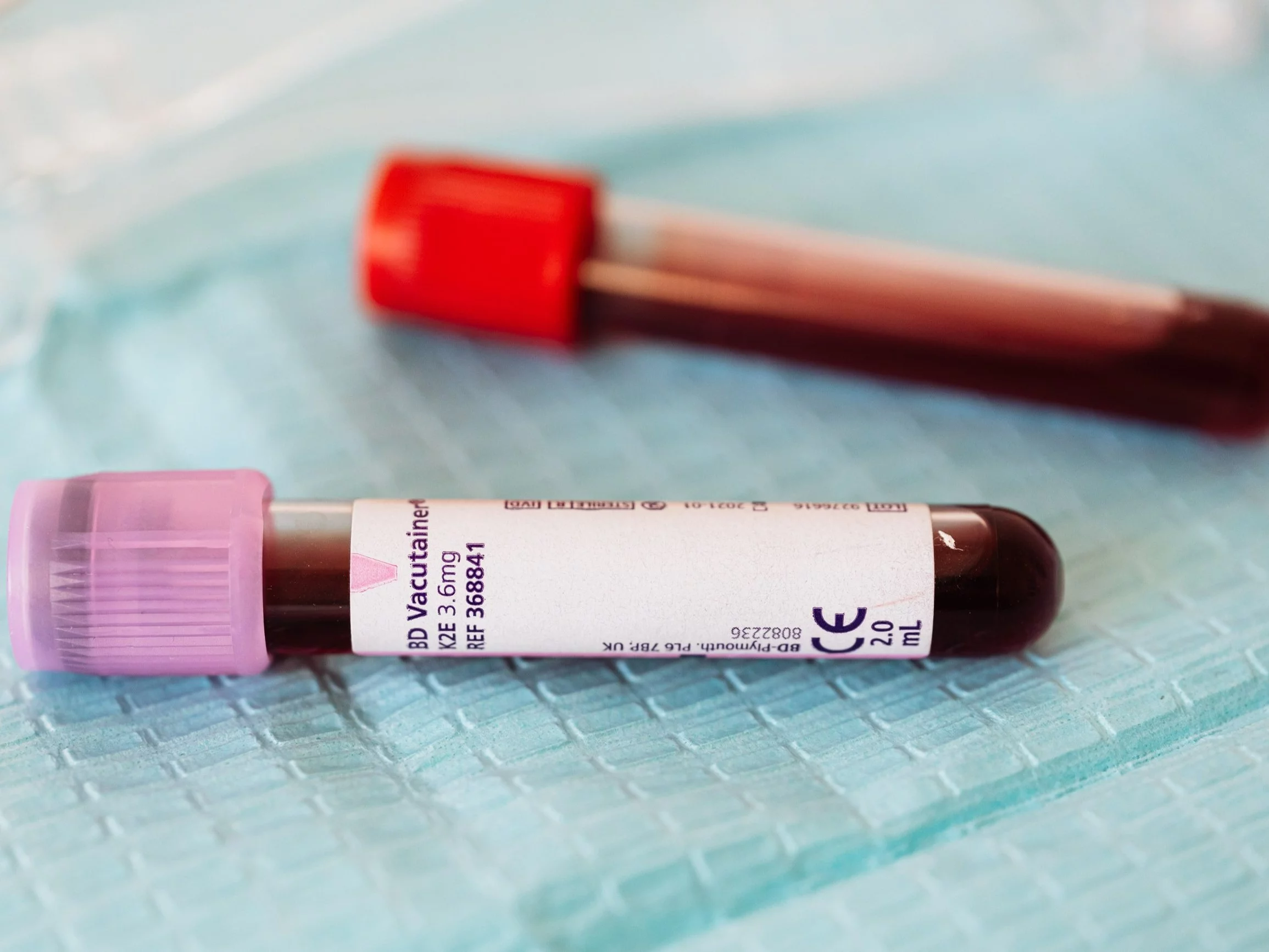 Ile wiesz na temat krwi? Już pierwsze pytanie może sprawić problem