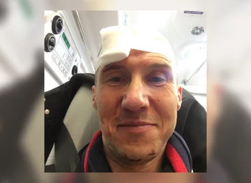 Mezo pokazał zdjęcia obrażeń po wypadku 