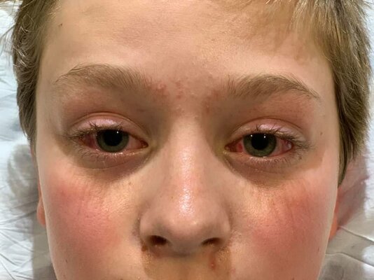 Miniatura: Oliver Schultz