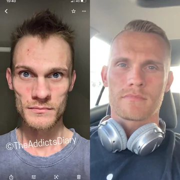 Zdjęcie przed i po wyjściu z nałogu 