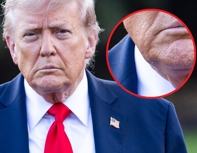 Miniatura: Trump i rzekomy udar. Internauci poddają...