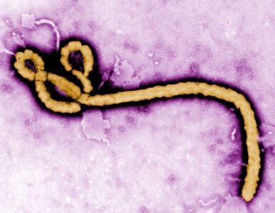 Miniatura: Wirus Ebola zbiera śmiertelne żniwo....