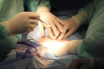 Chirurdzy w trakcie operacji