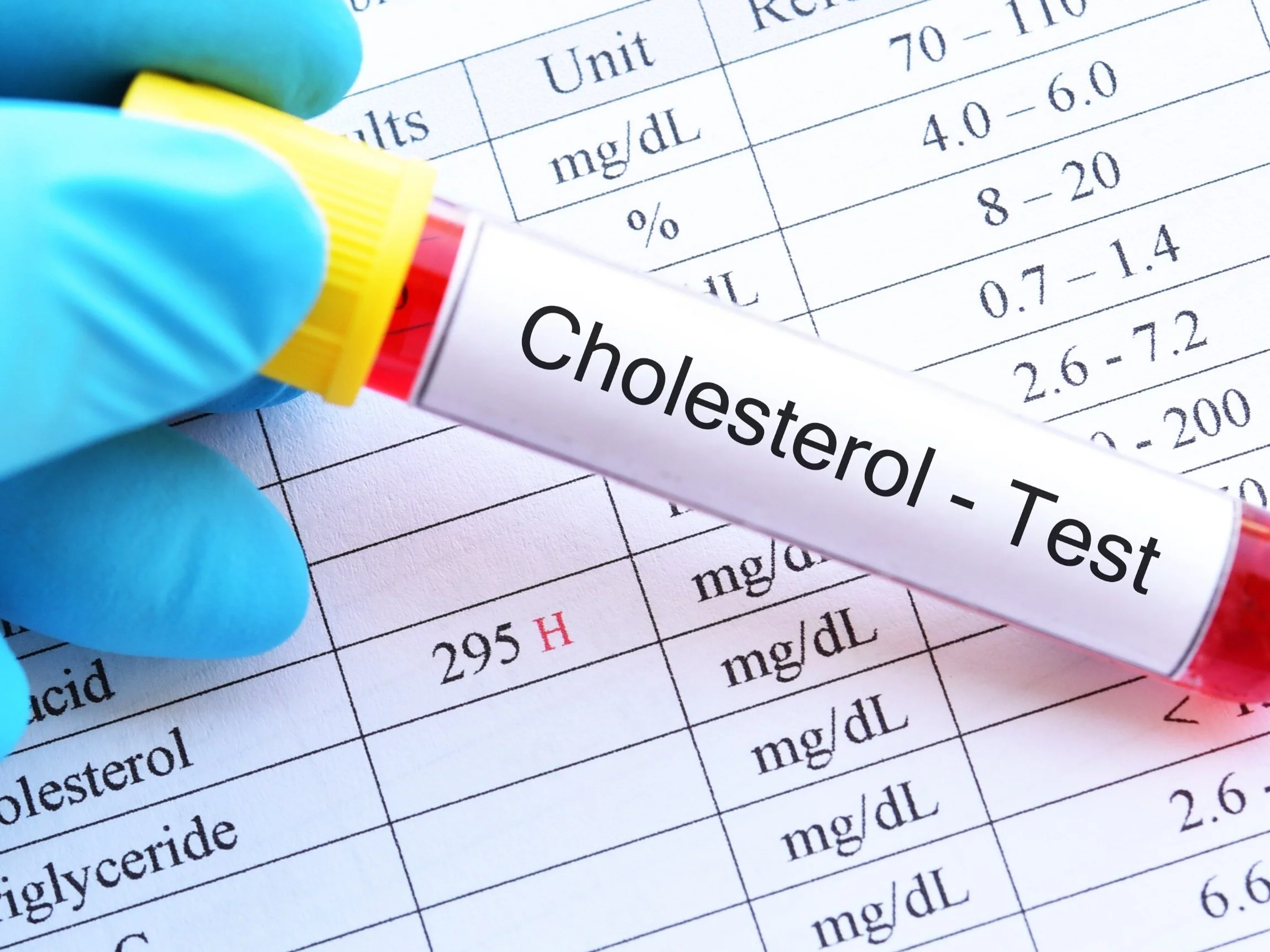 Cholesterol