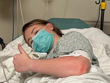 Emma Eggler w szpitalu po porażeniu piorunem