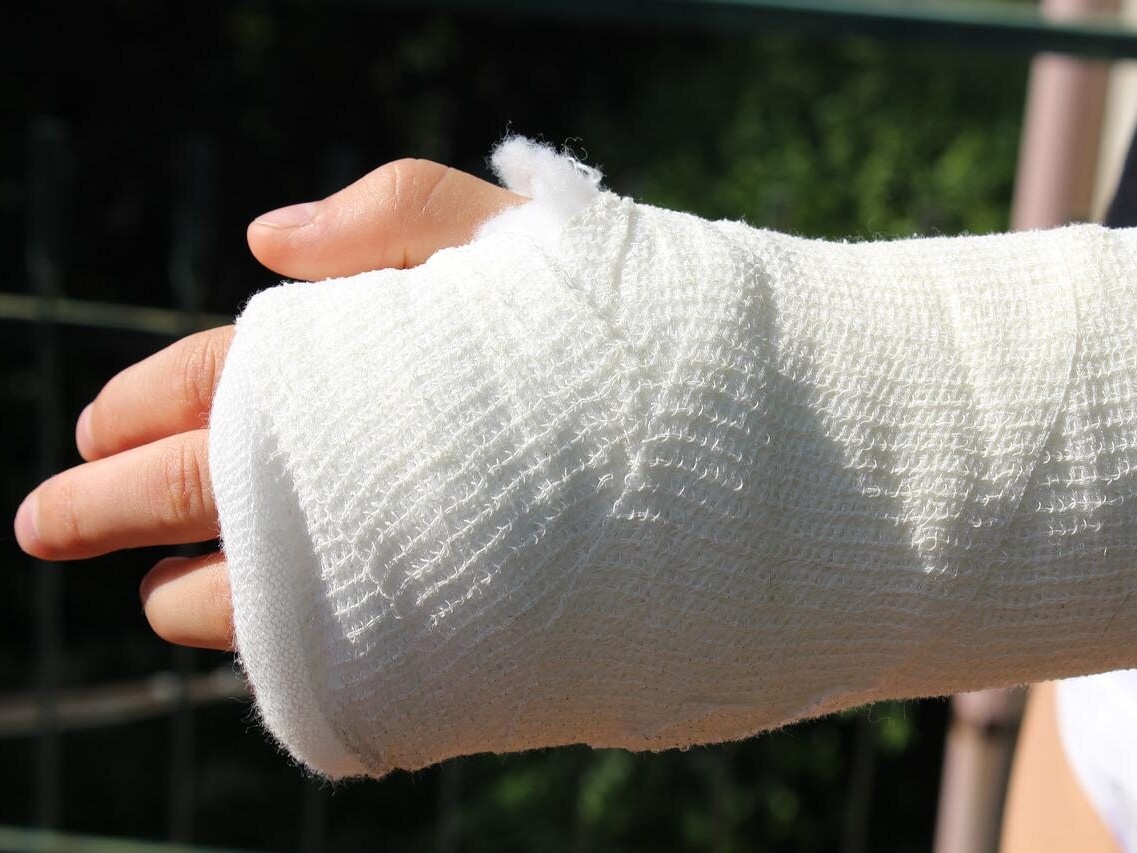 Gips to przeżytek. Naukowcy z Poznania mają alternatywę – Zdrowie Wprost