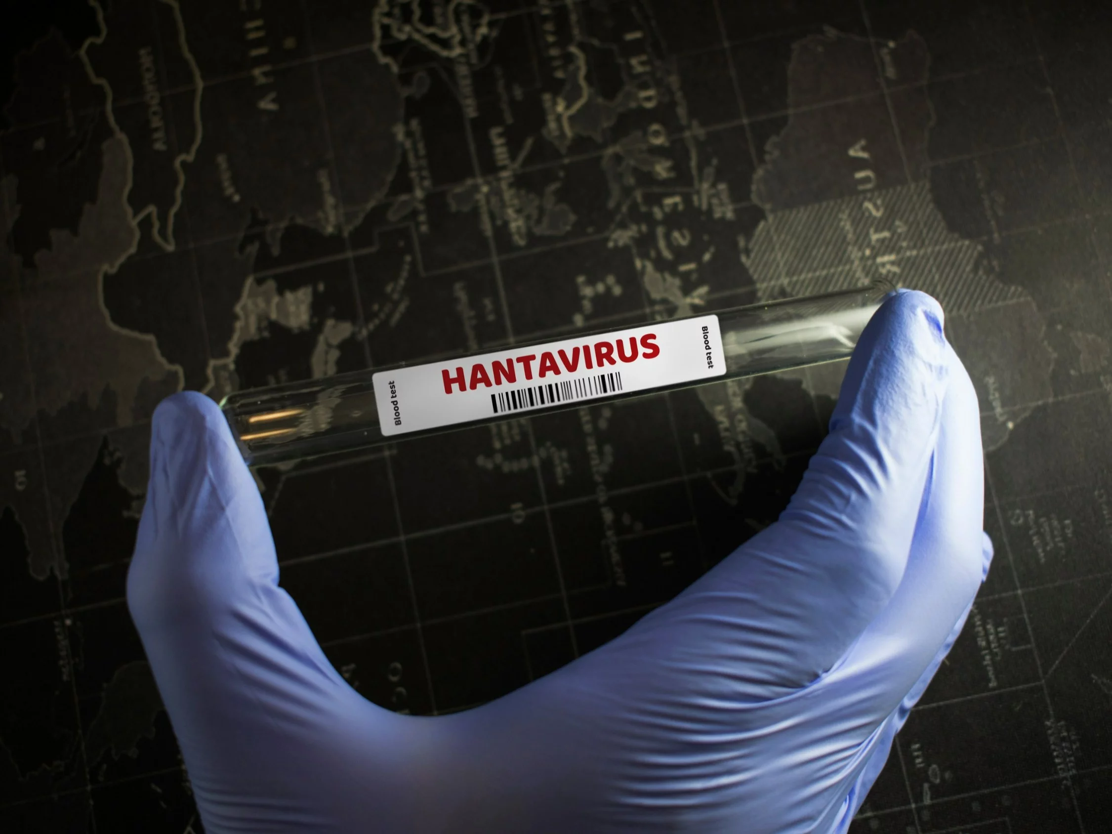 Hantawirus