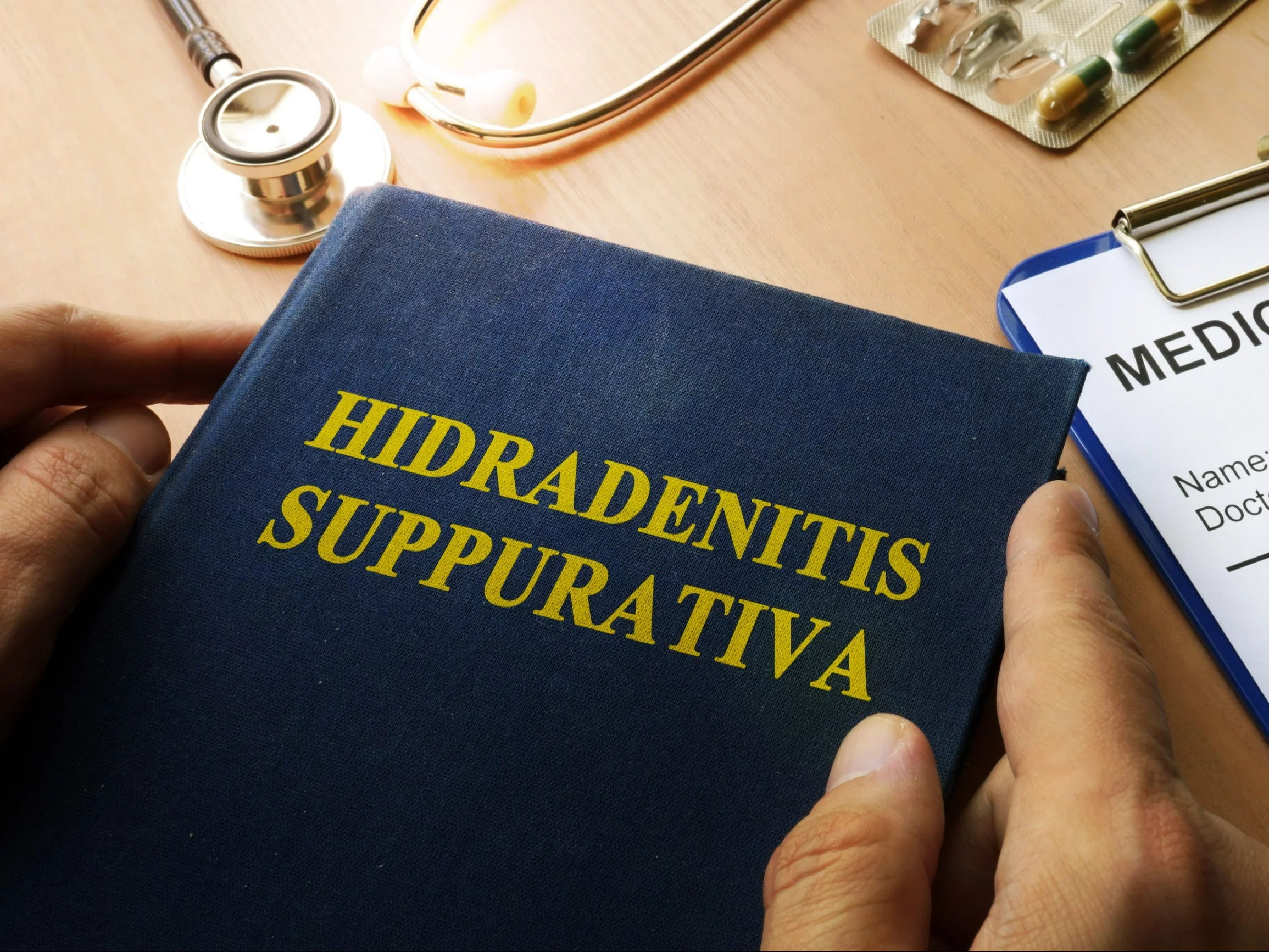 Hidradenitis suppurativa