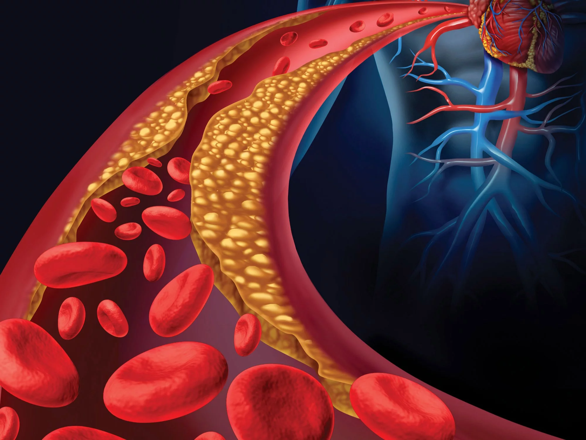 Cholesterol
