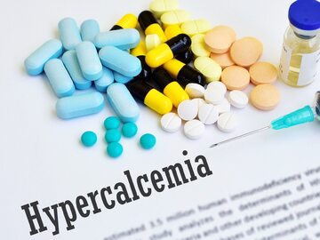 Hiperkalcemia