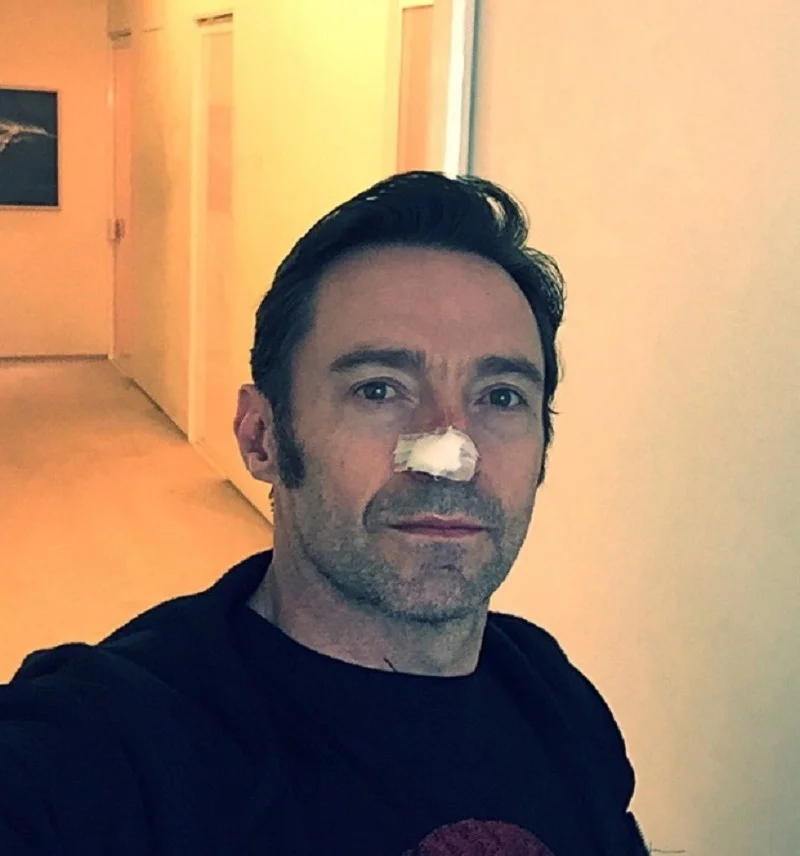 Hugh Jackman