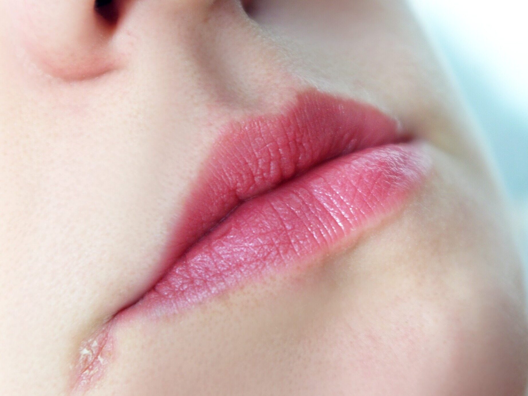 Las comisuras de los labios agrietadas pueden indicar la falta de una vitamina importante en su dieta.  ¿Qué?  – Salud Wprost