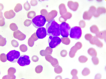 Komórki krwi, zdjęcie ilustracyjne