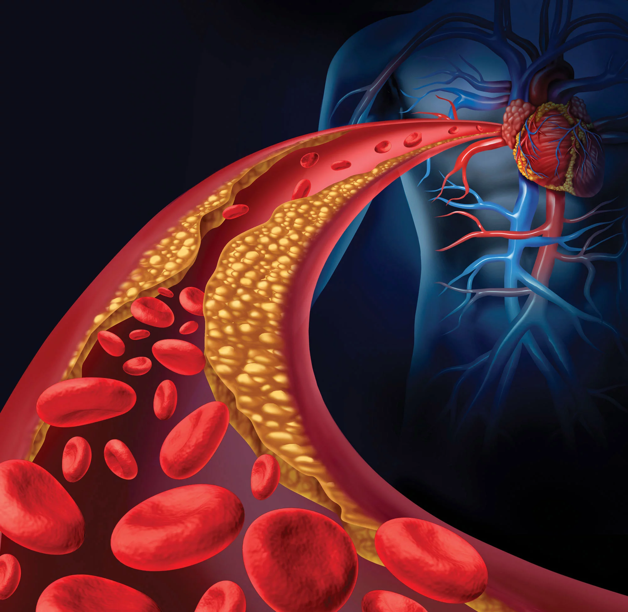 Cholesterol