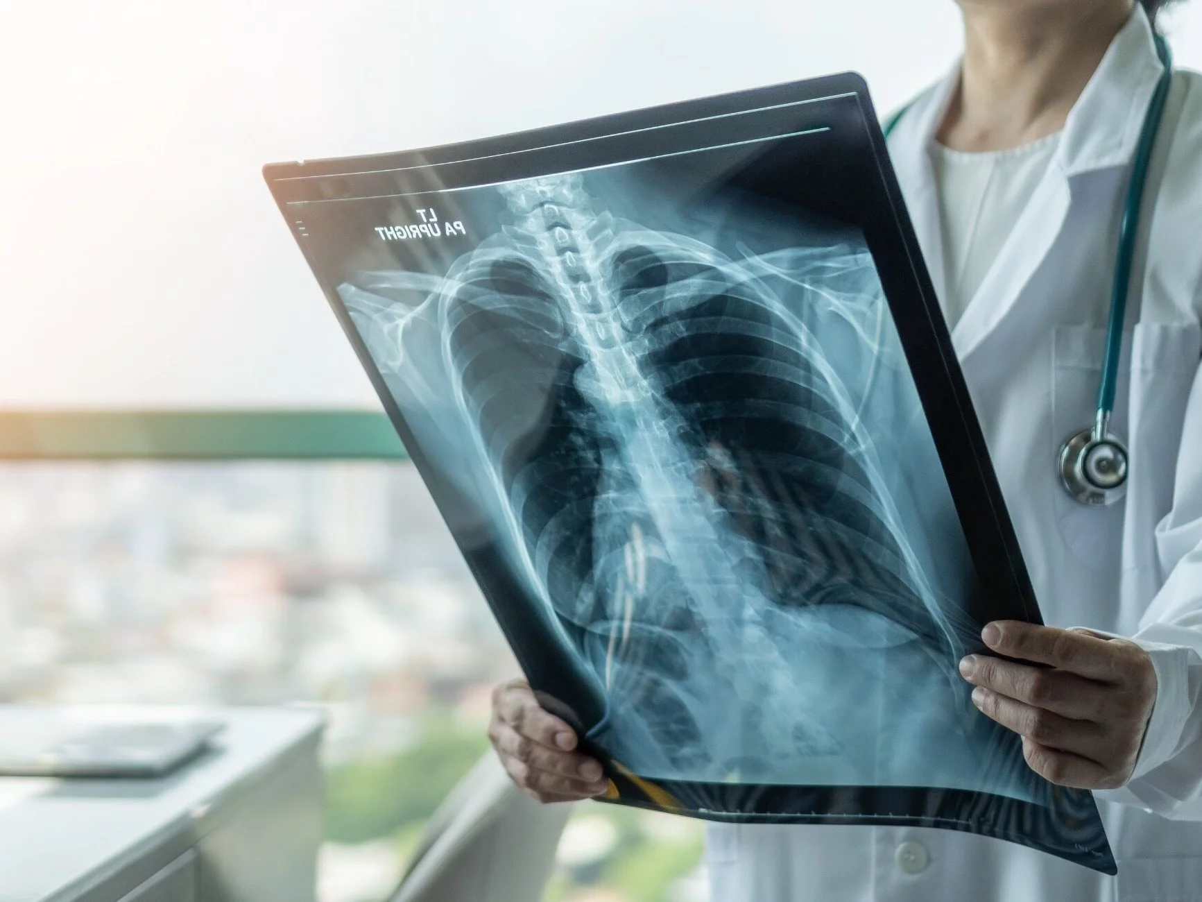 Choroby płuc wykrywane są w Polsce zbyt późno