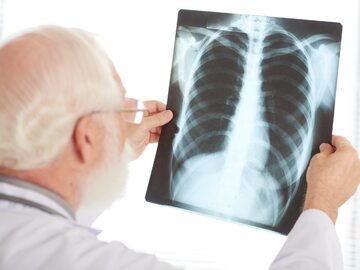 Lekarz ogląda zdjęcie rentgenowskie