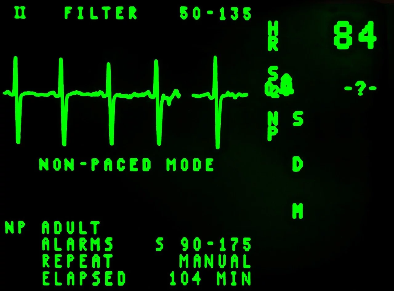 EKG