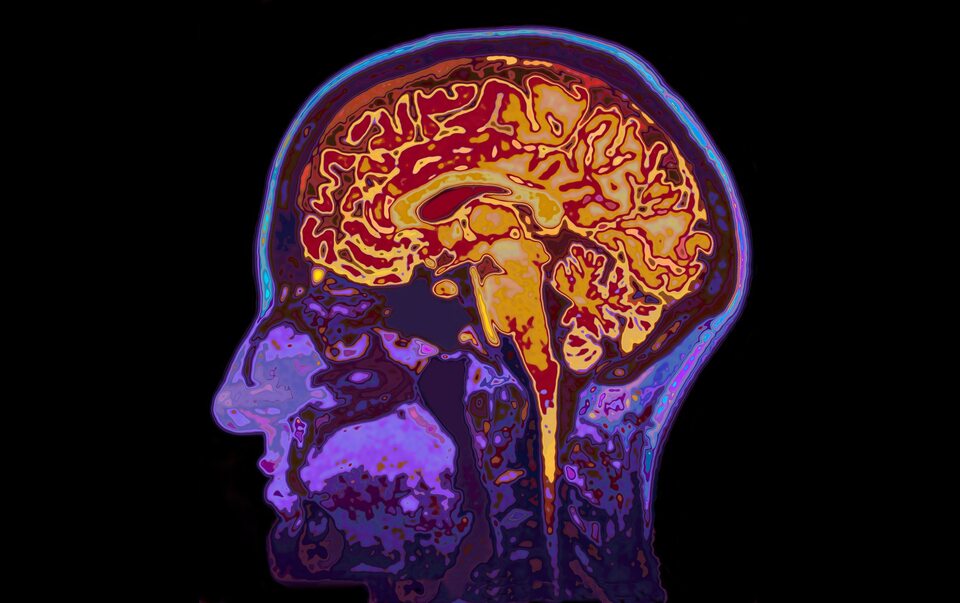 Co Dzieje Się W Mózgu Gdy Coś Sobie Wyobrażamy Zdrowie Wprost 2009