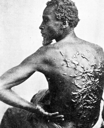 Niewolnik, który zbiegł z plantacji bawełny w Mississippi, 1863 rok