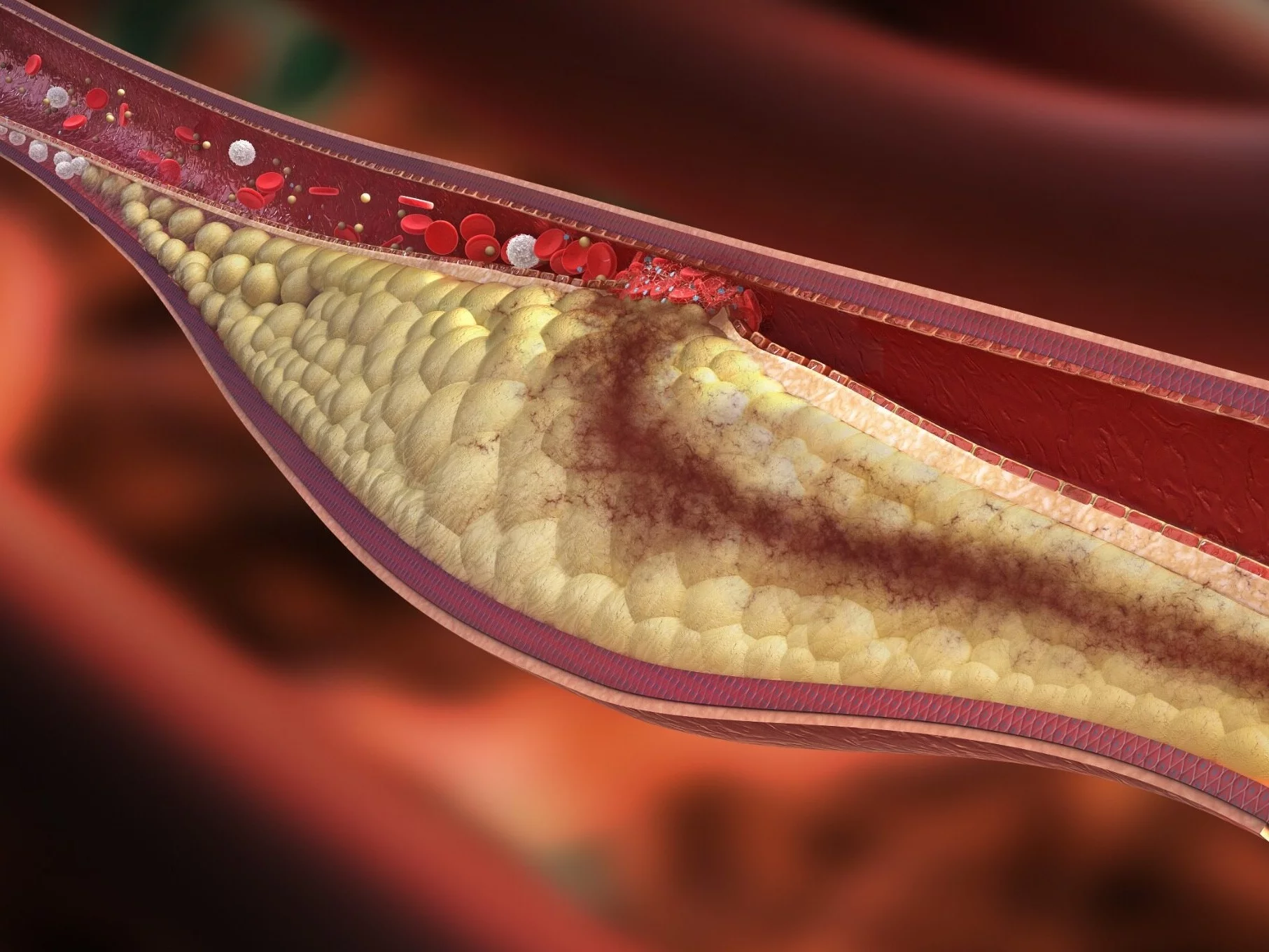 Cholesterol