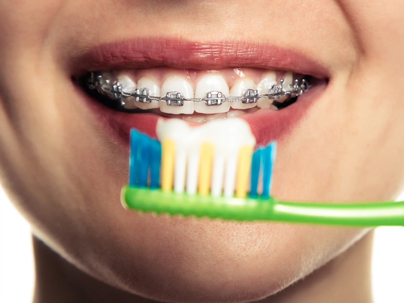 Odbudowa szkliwa nazębnego. Odkrycie naukowców z Londynu