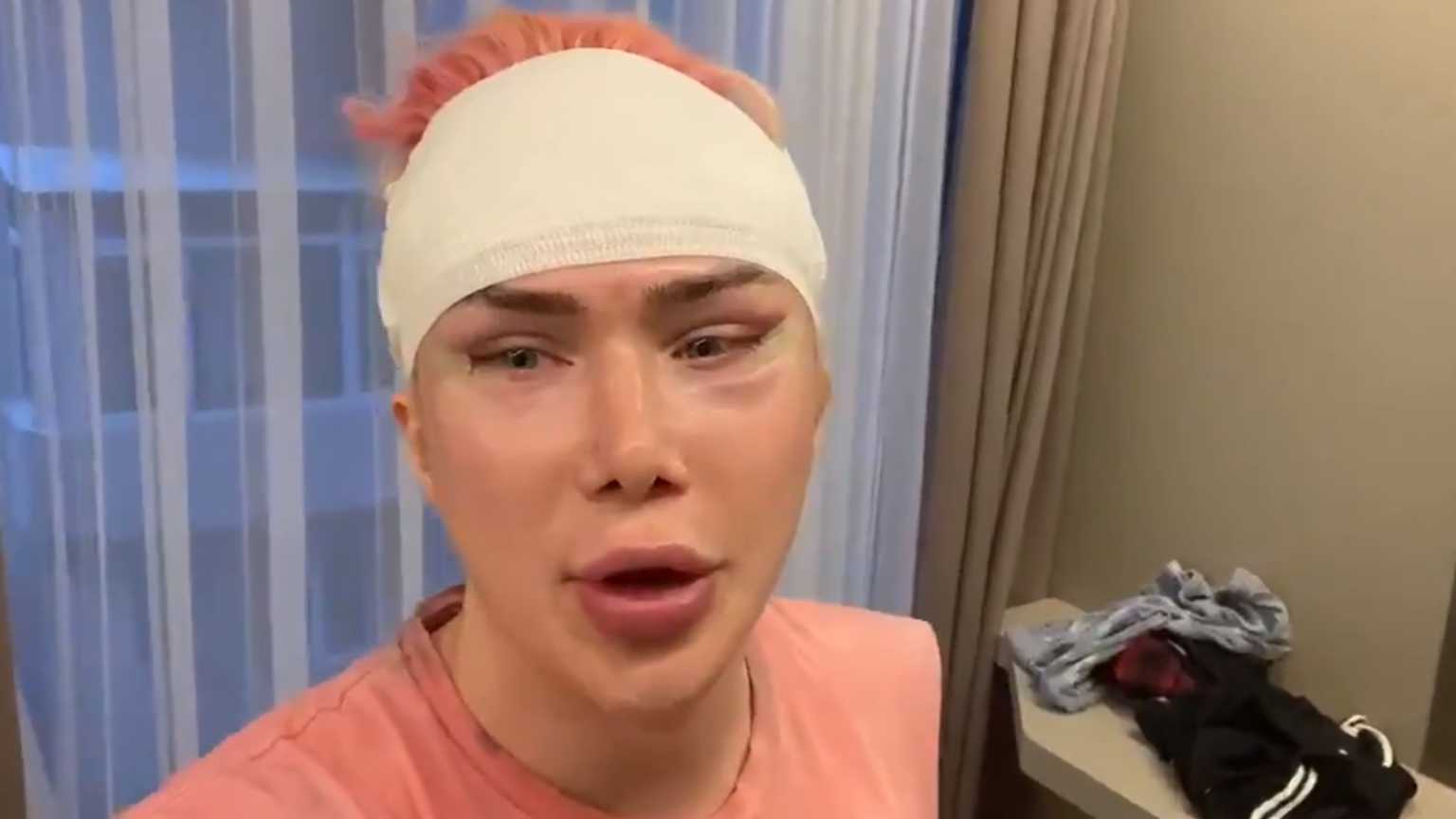 Oli London przeszedł 18 operacji plastycznych. Chciał „zmienić rasę