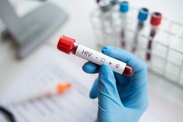 Pozytywny wynik testu na HIV. Zdjęcie ilustracyjne.