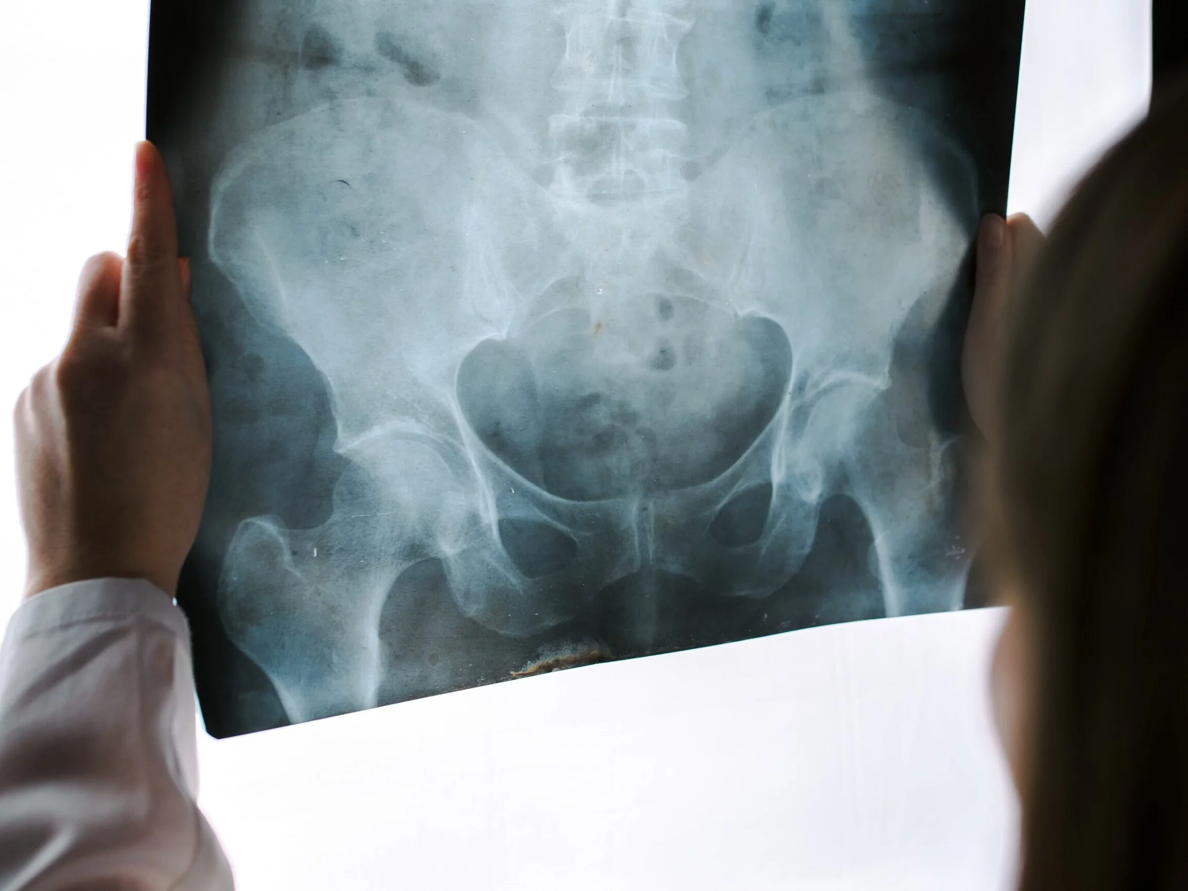 Przełom w diagnostyce wrodzonej wady stawów biodrowych u dzieci i niemowląt dzięki polskim informatykom