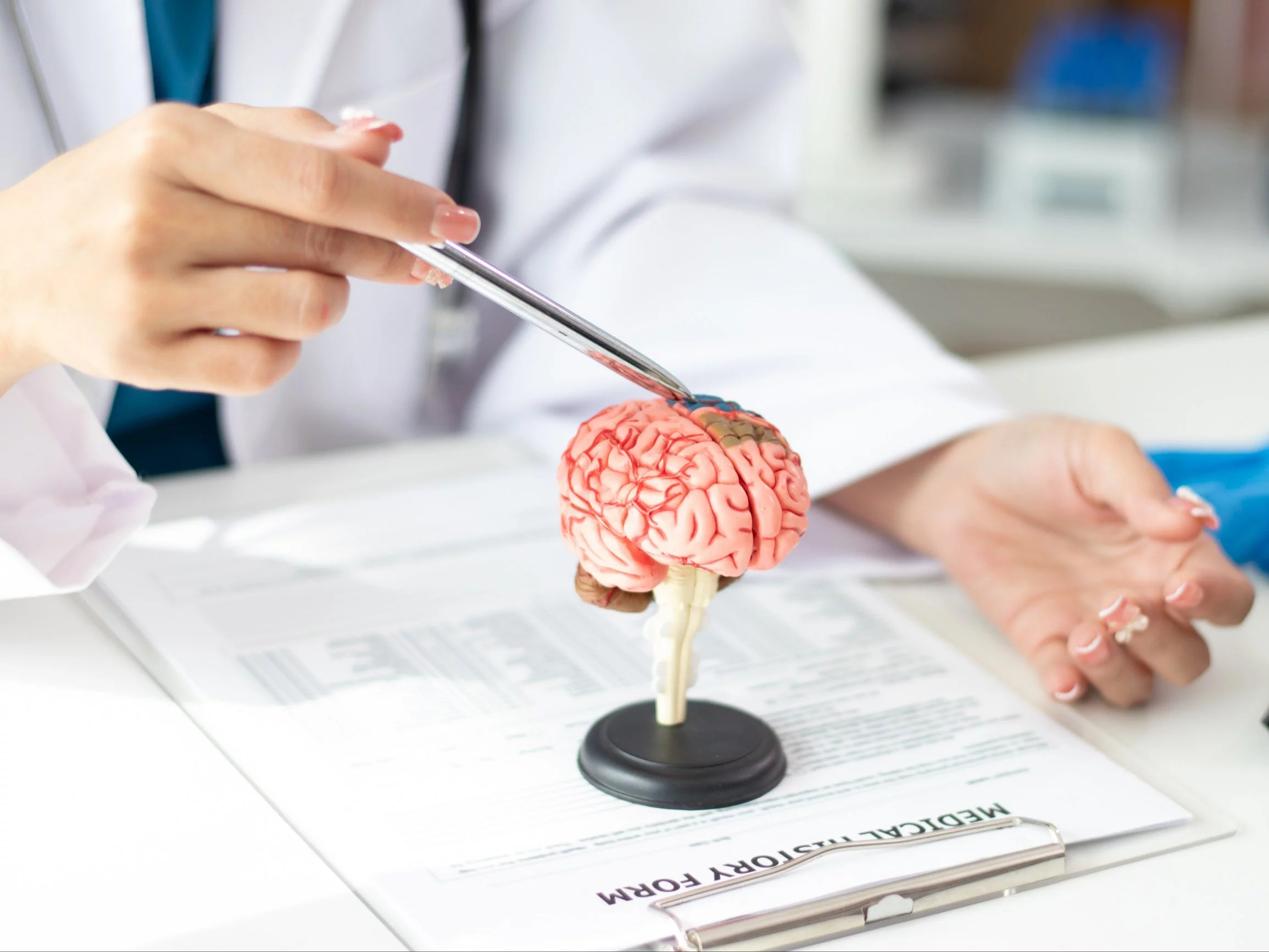 Model anatomii mózgu do diagnozowania i leczenia choroby alzheimera