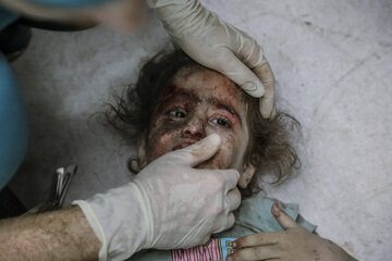 Ranne dziecko otrzymuje pomoc medyczną od lekarza w szpitalu w Gazie