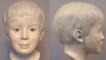 Rekonstrukcja twarzy chłopca