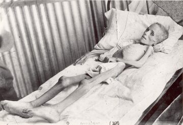 Siedmioletnia Lizzie van Zyl, która w wyniku niedożywienia i złych warunków sanitarnych panujących w obozie w Bloemfontein zapadła na dur brzuszny i zmarła