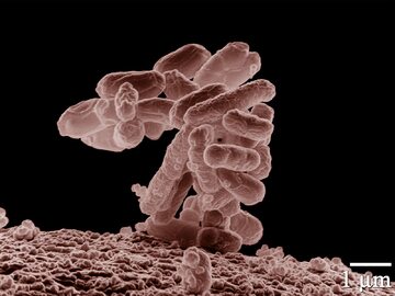Skupisko Escherichia coli powiększone 10.000 x