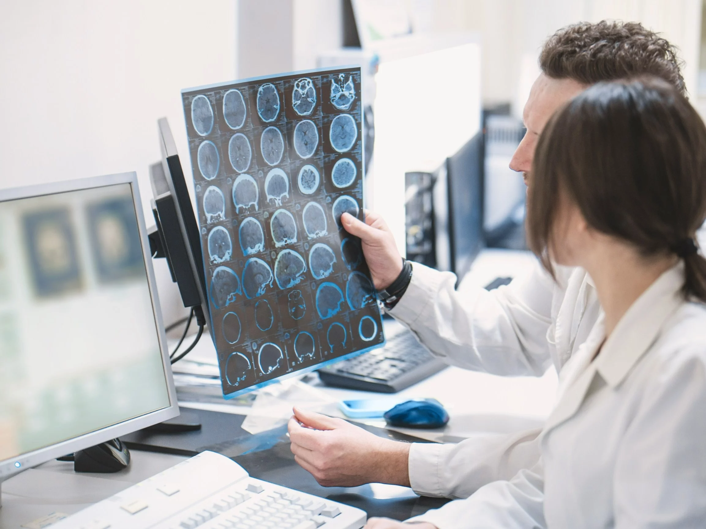 Stwardnienie rozsiane