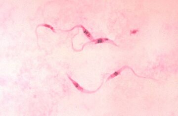 Świdrowce Trypanosoma cruzi w rozmazie krwi pacjenta z chorobą Chagasa