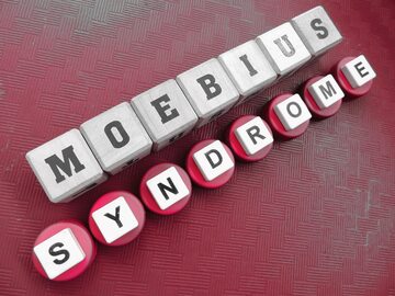 Syndrom Moebiusa