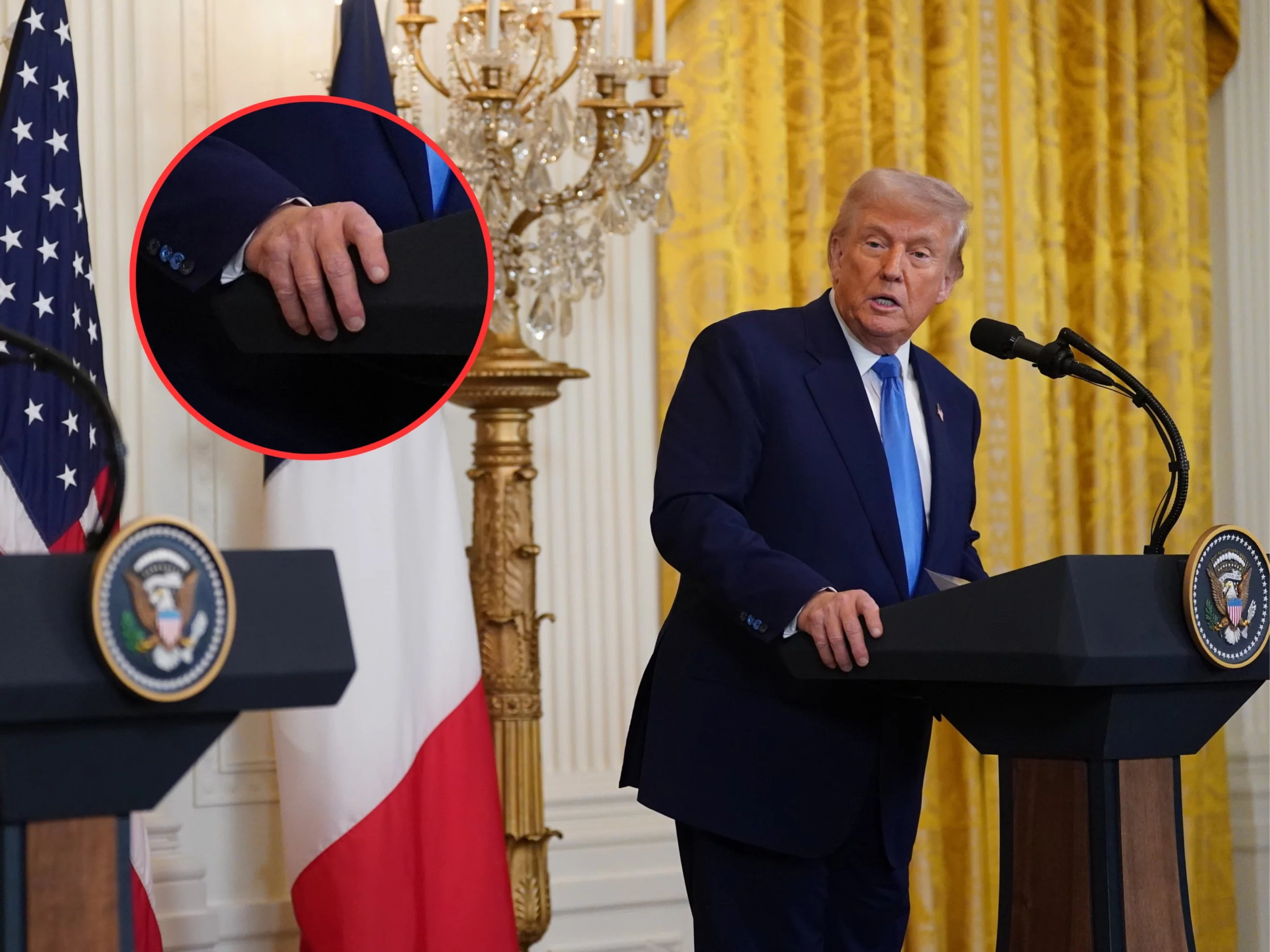 Tajemniczy siniak na dłoni Donalda Trumpa