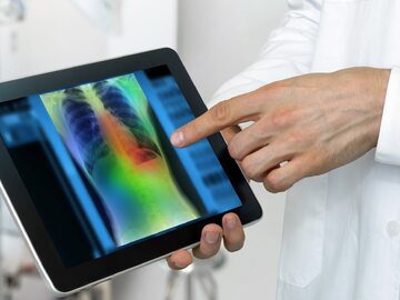 Technologia w służbie zdrowia