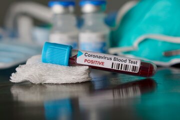 Test na koronawirusa, zdjęcie ilustracyjne