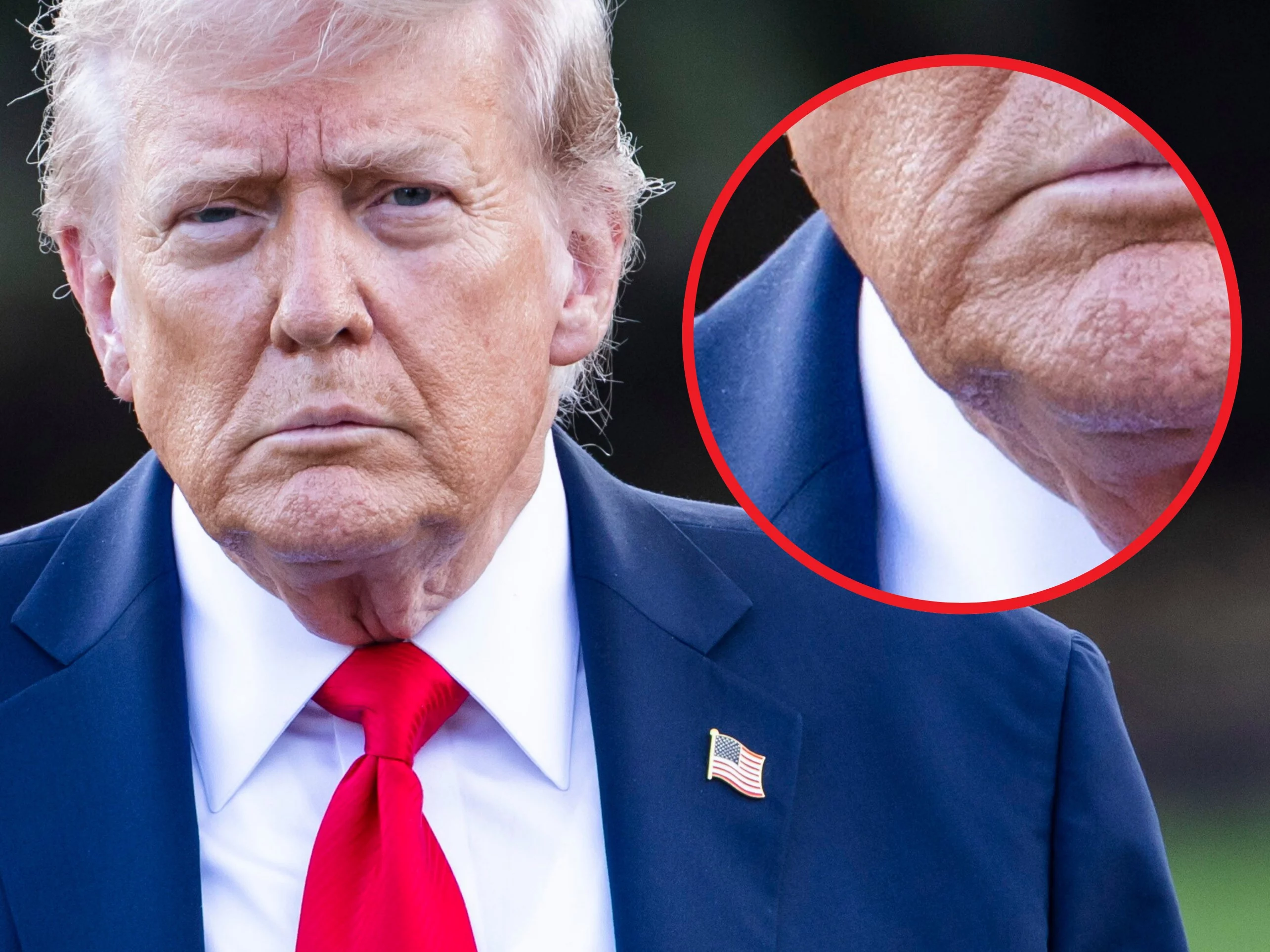 Trump i rzekomy udar. Internauci poddają analizie jego zdjęcia