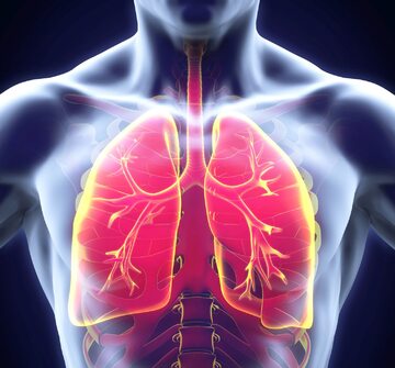 U osób z IPF pęcherzyki płucne nie mogą się odpowiednio rozszerzać, co zmniejsza ilość tlenu docierającego do krwi. To powoduje niedotlenienie narządów