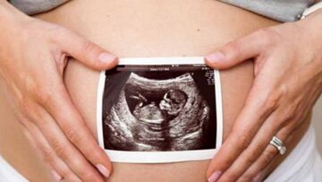USG w ciąży
