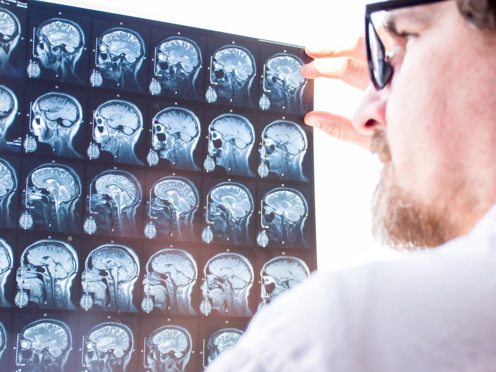 W tym wieku twój mózg zaczyna się starzeć. Wcześniej, niż myślisz