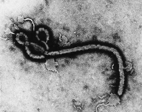 Wirus ebola w Wielkiej Brytanii za 3 tygodnie? (fot. Wikimedia Commons)
