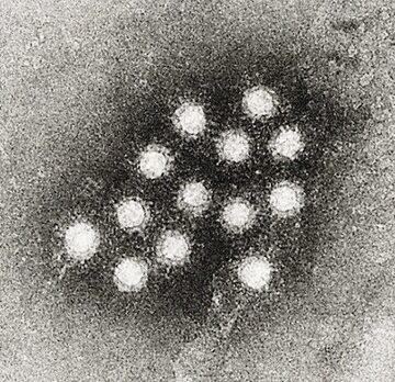 Wirus zapalenia wątroby typu A
