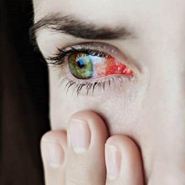 Czerwone Oczy Po Przebudzeniu Możliwe Przyczyny Zdrowie Wprost 4514