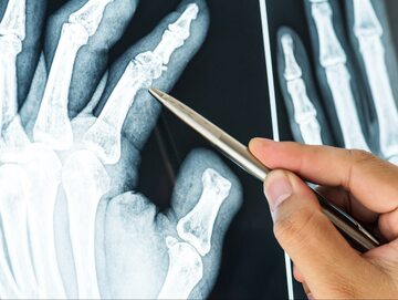 Zdjęcia rentgenowskie kości
