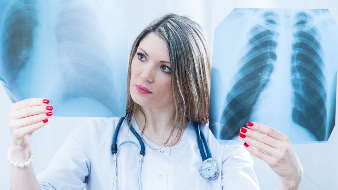 Zdjęcia rentgenowskie (RTG) klatki piersiowej